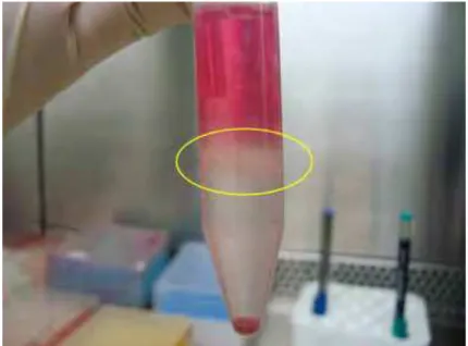 FIGURA 4 – Fração de células mononucleares separadas por  diferença de densidade. Região em destaque (circulo amarelo)  evidenciando o anel formado de onde serão coletadas as  células para cultivo