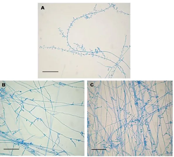 Figure 2. Light microphotographs of T. rubrum ATCC 1683 mycelium growing on ASD without or with C