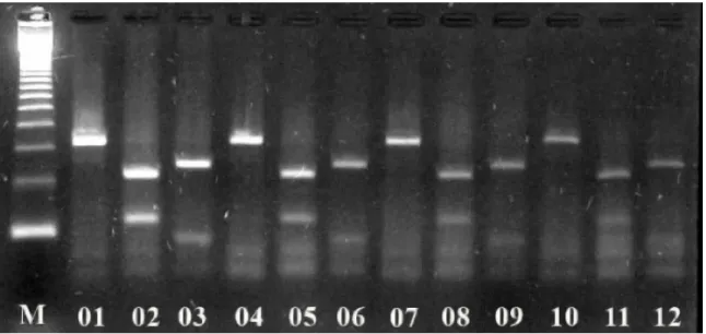 Figure  2.  Ethidium  bromide  stained  2%  agarose  gel  electrophoresis  of  restriction  fragment  length  polymorphism  (RFLP)  with  Hinf  I  and Vsp  I  enzymes  of  Helicobacter spp