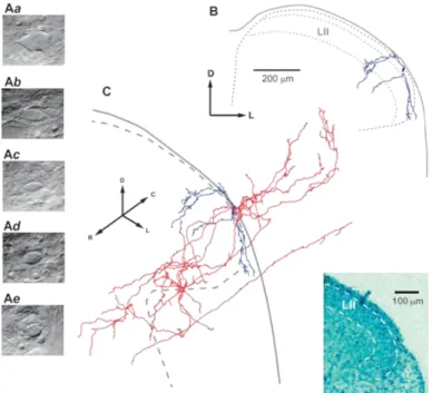 Figure 1. Imaging and reconstruction of lamina I small neurons. Living cell images comparing large (Aa and b) and  small (Ac-e) lamina I neurons