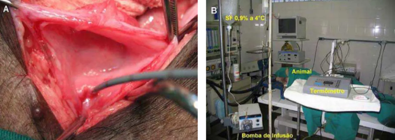 Figura 4 – Grupo 1. (A) cateter ureteral duplo lúmen; (B) disposição dos instrumentos na  sala de cirurgia 
