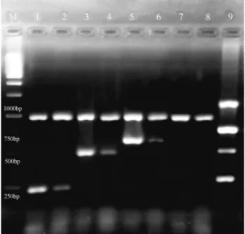 Figure 1 - Agarose gel analysis of RT-PCR products from A. parasiticus ATCC 56775 on day5 Z.multiflora EO (100 ppm)
