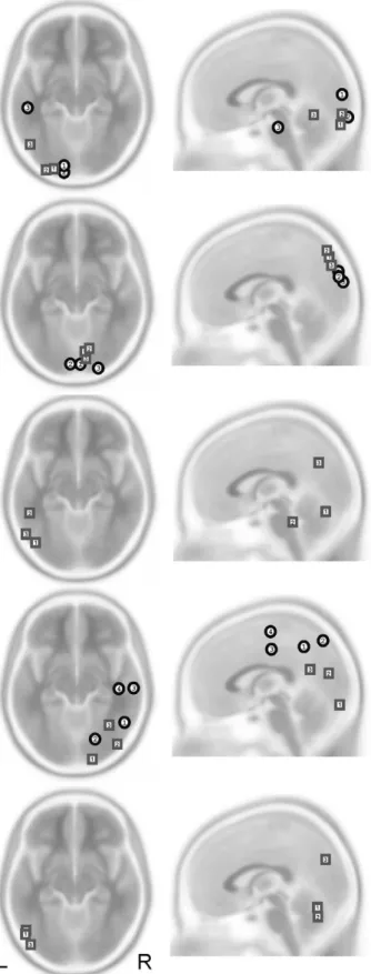 Fig. 5. Propagation patterns and temporal evolution of central spike generators for patients 3 (above), 4 (middle) and 5 (below)