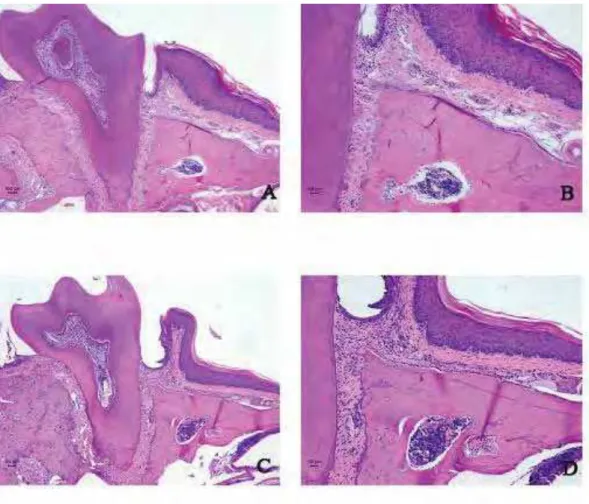 FIGURA 10 (A a D) – Fotomicrografia da região do primeiro molar superior  esquerdo dos animais do grupo ligadura, dos períodos de 7(A) e 30(C) dias
