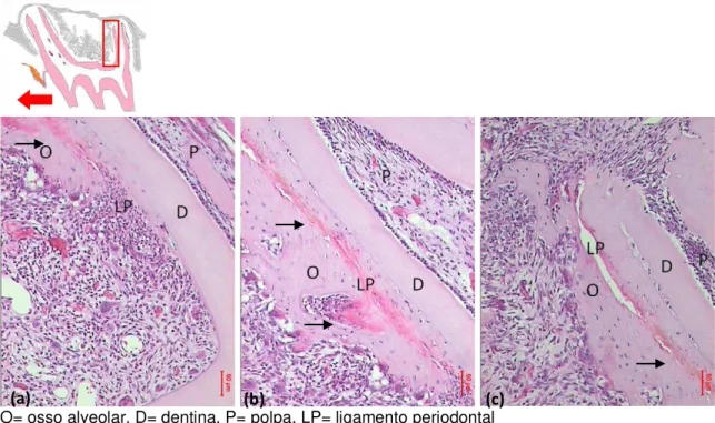 Figura  7  -  Grupo  GM5  -  periodonto  da  face  mesial  da  RDV:  (a)  terço  cervical  exibindo início de reabsorção radicular (seta) e perda óssea; (b) terço médio e (c) terço apical  exibindo LP com aspecto de normalidade e presença de células gigant