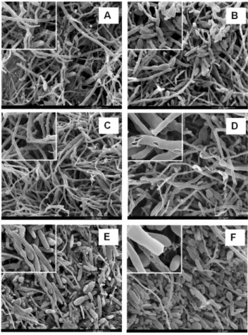 Figure 2 - Electron micrographs of F. verticillioides 103 F mycelia cul- cul-tured in defined liquid media in the absence (control) and presence  (treat-ment) of fludioxonil + metalaxyl - M at the dose recommended by the manufacturer (1.5 mL mL -1 )
