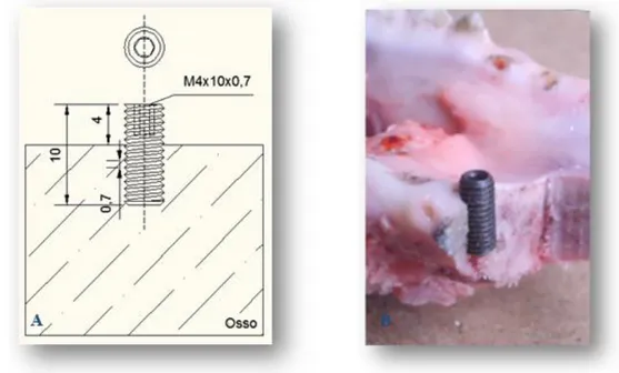 Figura 2.14. A) Ilustração do implante M5x12x0,8 mm em 2D; B) Fotografia em corte da mandibula após a  inserção do implante M5x12x0,8 mm