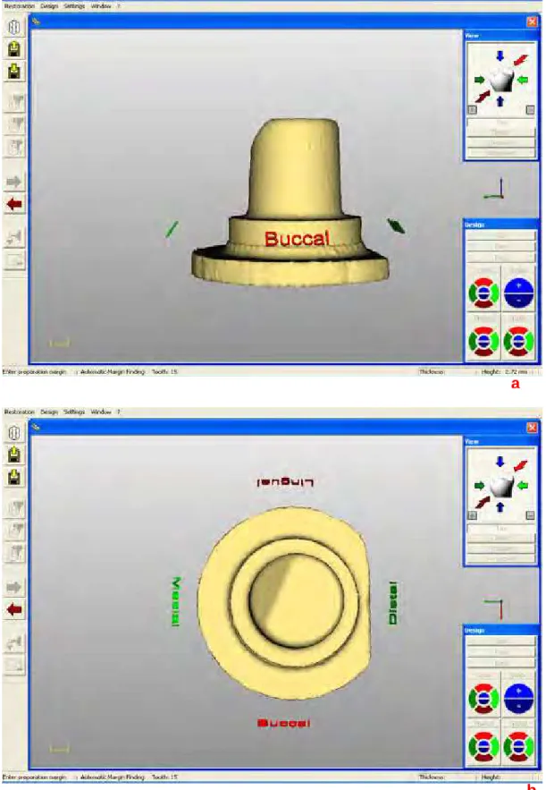 FIGURA 11 - Imagem digitalizada em 3D do preparo com término em ombro  arredondado: a) vista lateral e b) vista oclusal