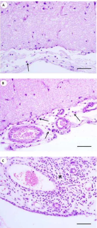 FIGURA 2 - Fotomicrografias representativas da intensidade do infiltrado inflamatório  em  leptomeninges  de  cães  com  leishmaniose  visceral