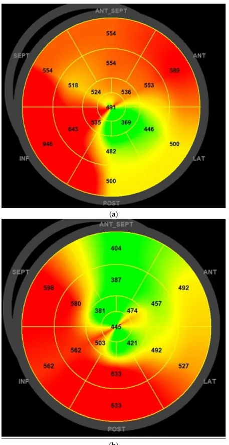 Figure 2. Mechanical dispersion bullseye plot reduction before (a) and after (b) six months of LCZ696  therapy