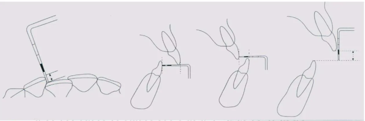 Figura 3. Desenho esquemático para o uso da sonda IPC 