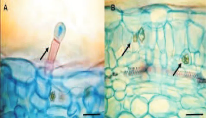 Figura  1.  Fotomicrogra! as  de  secções  transversais  de  folhas  de  morangueiro  cultivadas  in  vitro  com  diferentes  fontes  de  silício