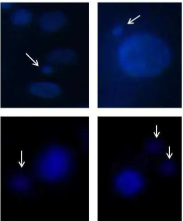 Fig  7.  Micronuclei  (MN).  MN  are  DNA  fragments  located  around  and  close  to  the  cell  nucleus  (indicated  by  white  arrows),  and  may  have  variable size but always smaller than the cell nucleus and varied amount,  as  shown  in  the  figur