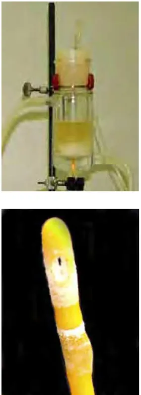Figura 9: Cateter removido. As incrustações responsáveis  pelo bloqueio do cateter são visíveis e o “olho” do cateter  mostra-se recoberto por elas 