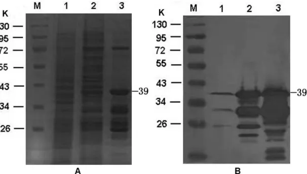 Figure  1.  Expression  and  purification  of  the  preS1.  (A)  10%  SDS–PAGE.  B.  Immunoblotting  with  anti-preS1  monoclonal  antibody