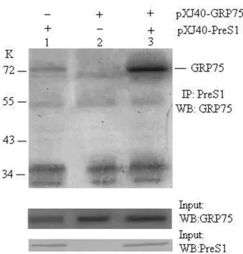 Figure  3.  GRP75  binds  to  PreS1  in  vivo.  The  COS7  cell  lysates,  co-transfected  with  PreS1  (lane  1)  and   pXJ40-GRP75  (lane  2)  either  alone  or  both  (lane  3),  were  immunoprecipitated  with  anti-PreS1  antibody