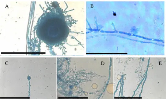 Figure 1. Light microphotographs of A. flavus ATCC-16013 mycelium growing on AS without or with H
