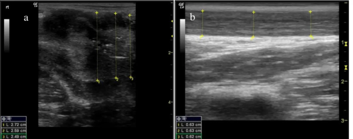 Figure 3. Ultrasound image (longitudinal section) of the (a) Vaginal vestibulum with three measurements of the  diameter – African lion, 23/08/2015; and (b) vagina with three measurements of the diameter – Kayla, African  lion, 28/09/2017