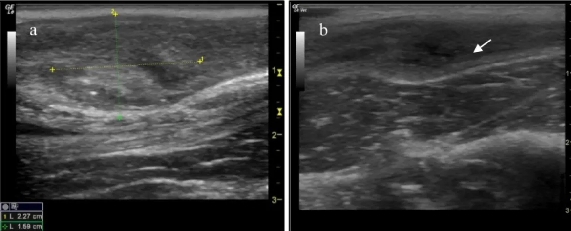 Figure 4. Ultrasound image (longitudinal section) of the (a) cervix with measurement (length measurement 1 and  height  measurement  2)  in  an  African  lion,  28/09/2017;  and  (b)  cervix  showing  folds/lumen  (arrow)  –  Isantya,  Cheetah, 13/06/2018