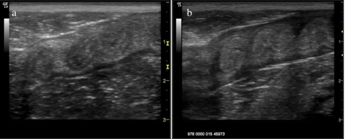Figure 7. Ultrasound image (longitudinal section) of the uterine horns of two females during dioestrus – (a) Kayla,  African lion, 28/09/2017 (b) female 2 white, African lion, 23/08/2015