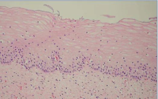 Figura 1.  Fotomicrografia do colo do útero representando epitélio normal. HE. 