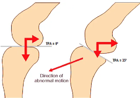 Figure 7 Schematic representation of the forces acting on the tibia during weigh bearing