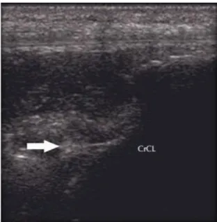 Figure 13 Ultra sonographic image of a ruptured CrCL: The ligament presents with irregular ends (arrow)  consistent with a complete rupture (C