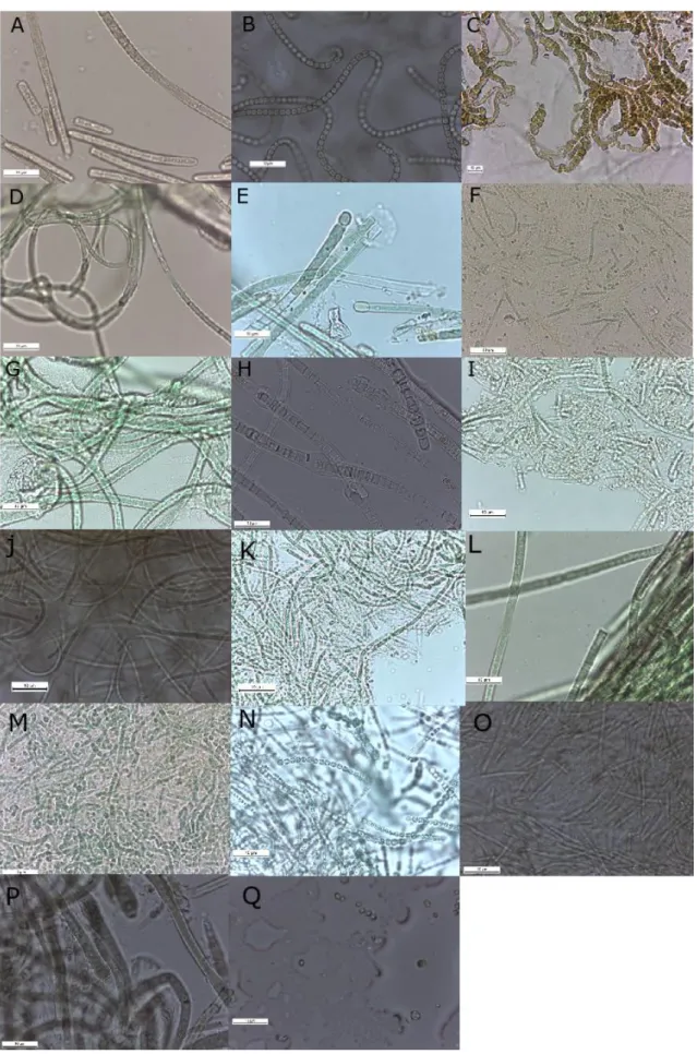 Figure 3. Diversity of different morphotypes among strains; (image C at 400x magnification, all others at 1000x); A-   Microcoleus sp.; B- Nostoc sp.; C- Roholtiella edaphica; D- Timaviella sp.; E- Tolypothrix sp.; F- Nodosilinea epilithica; 