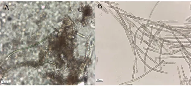 Figure 5. A- ENV003 environmental sample showing Microcoleus spp. B- Microscopic preparation of biomass collected  from the ENV003 agar plate, during the later stages of isolation, showing the Microcoleus vaginatus strain