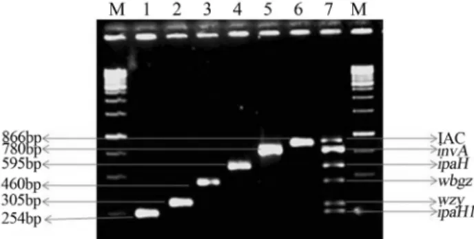 Figure 1 - Agarose gel showing monoplex and multiplex PCR format.