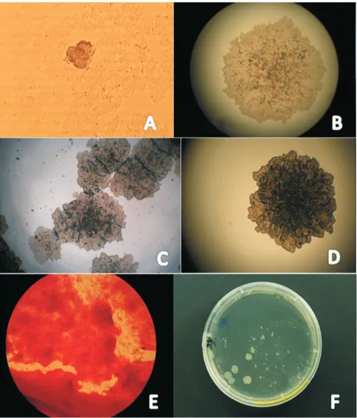 Figure 1 - Mycobacterium bovis colonies isolated in modified Middlebrook 7H11 medium thin layer culture showing the microscopic and macroscopic growth phases with Ziehl-Neelsen stain