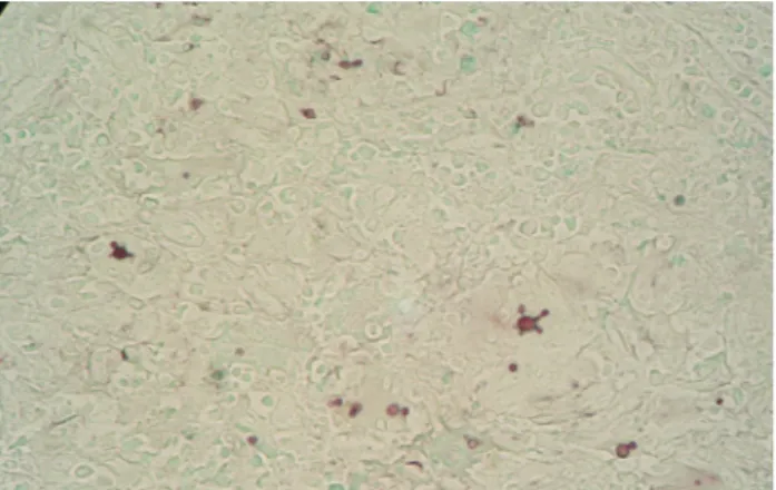 Figure 1 - Histological section of a lesion in the oral mucosa stained with Gomori-Grocott
