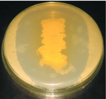 Figure 1 - Agar overlay method for determining the antibacterial potential of secondary metabolite produced by Streptomyces parvulus RSPSN2.