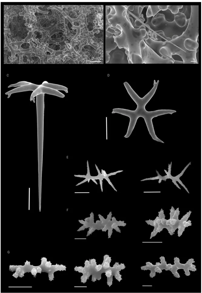 Fig. 7 - Neoschrammeniella bowerbankii (Johnson, 1863). A, overview of dicranoclone desmas (scale 100 µm); B, detail of 