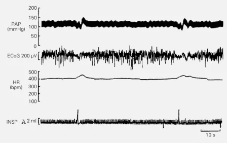 Table 1 shows the changes in diastolic arterial pressure and heart rate associated with deep breaths during the awake state (-7