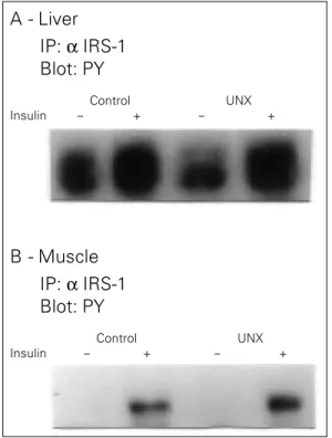 Figure 2 - Effect of unilat- unilat-eral nephrectomy (UNX) on insulin receptor substrate 1 (IRS-1) in the rat liver and muscle
