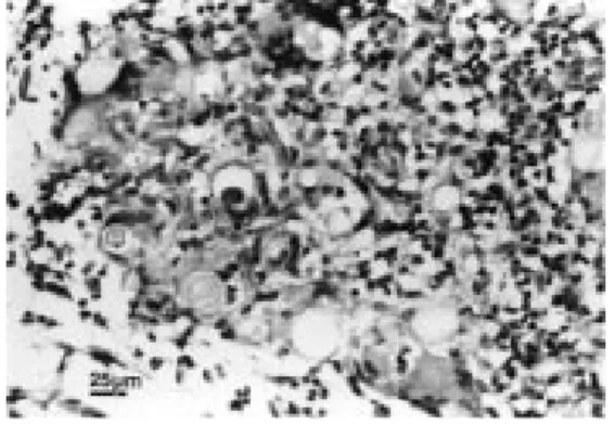 Figure 1 - Compact granulomas in the lungs of Wistar rats 60 days after inoculation with  P.