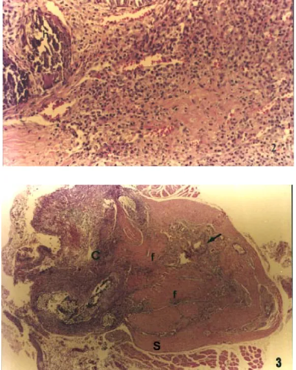 Figure 2 - Hydroxyapatite (h) sur- sur-rounded by young granulation tissue and inflammatory cells (enucleated 15-day group; HE, X100).