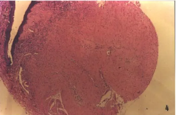 Figure 4 - Dense fibrous tissue filling the entire ocular cavity (eviscerated 60-day group; HE, X40).