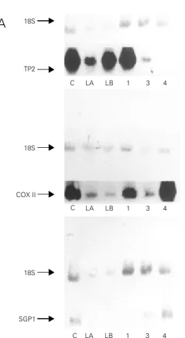 Figure 2 - Northern blot analysis of TP2, COX II and SGP1 mRNA expression in germ cell-enriched fractions