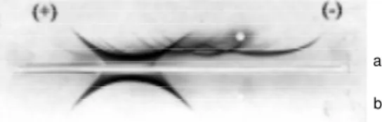 Figure 5 - Immunoelectrophore- Immunoelectrophore-sis of human plasma (a) and  al-bumin (b) prepared by the  meth-od described here