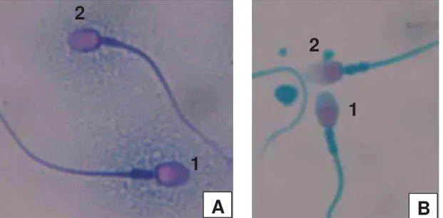 Figura 11. Fotomicrografia de espermatozoides de Alouatta caraya corados com corante  simples para acrossoma (A) e Spermac ®   (B)