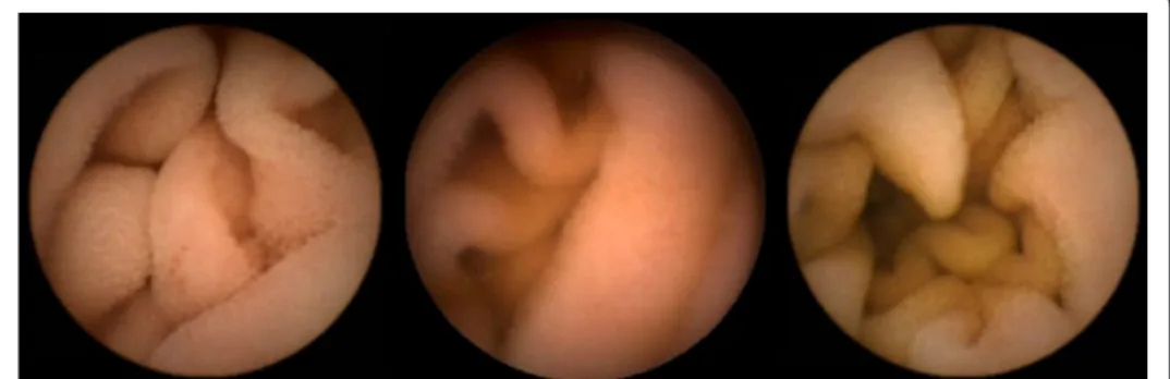 Figure 4 Examples of normal intestinal tissue frames. In this figure, several examples of CE frames comprising texture patterns from normal tissues are shown.