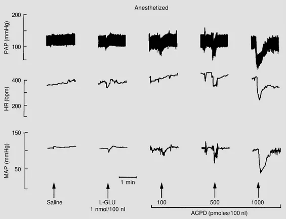 Figure 2 presents a tracing of the same representative rat as used in Figure 1, now under chloralose anesthesia, which also  re-ceived microinjections of saline,  L-gluta-mate and 3 doses of trans-(±)-ACPD into the NTS