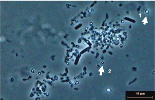 Figure 10. Spores and crystals in tryptose based media as seen by  microscopy *1-Spore 2-Crystal