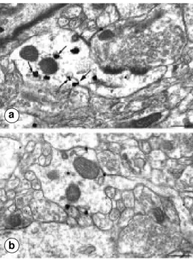 Figure 3 - Electron microscopy localization of sst2A receptors using silver-enhanced  immu-nogold in the bed nucleus of the stria terminalis (a) and claustrum (b)
