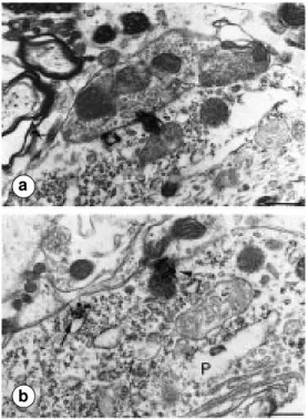 Figure 6 - Electron microscopy detection of radioautographically labeled  125 I-NT-binding sites in the rat substantia nigra