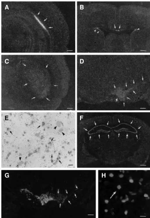 Figure 1 - Photomicrographs of film autoradiograms (A-D,G) and bright-field microscopy (E) of coronal sections of rat brain showing in situ hybridization of bFGF mRNA (A-D) and tyrosine hydroxylase mRNA (G) after unilateral nigral injection of saline (A-B)