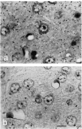 Figure 2 - Autoradiographs of Feulgen-prestained and light green-poststained paraffin  sec-tions showing comparable parts of the cortex 1 h after [ 3 H]-TdR injection of a 6-month-old mouse (a), or of a control mouse which received no [ 3 H]-TdR (b)