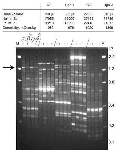 Figure 4 - M essenger RNA differential display profile of mouse kidney treated w ith and w ithout uroguanylin
